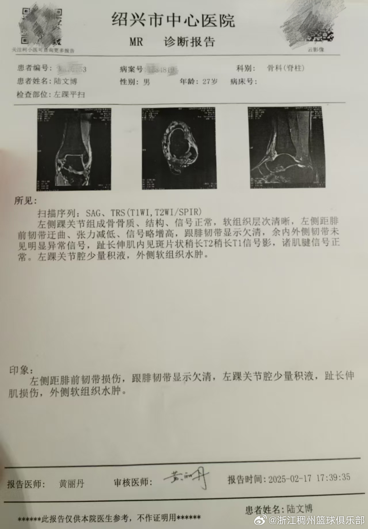頭號射手